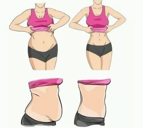 Abdomen